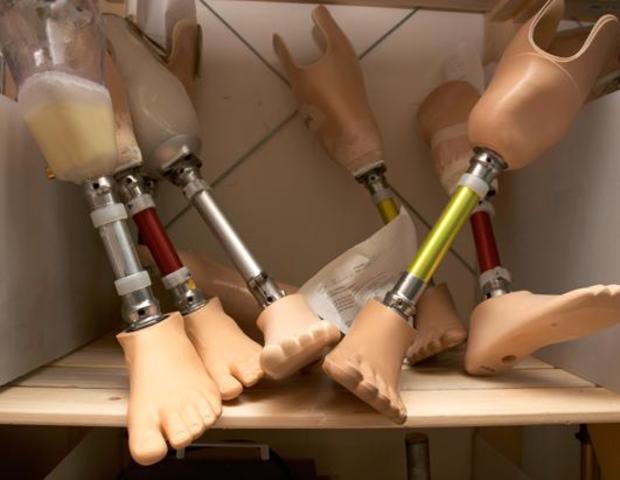 prosthetic leg.jpg